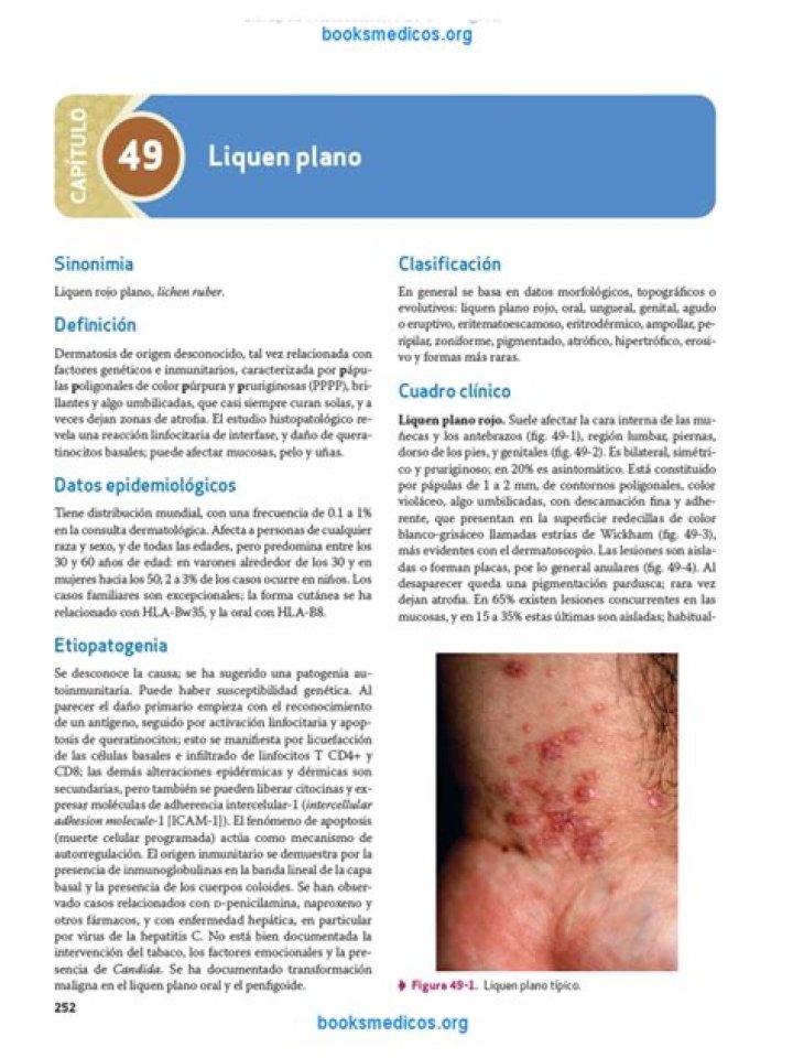 Liquen Plano Pilaris PDF: Diagnosis & Treatment Guide