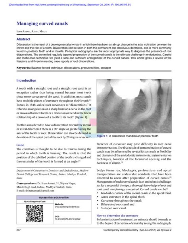 Mastering Management of Curved Canals: Essential PDF Guide