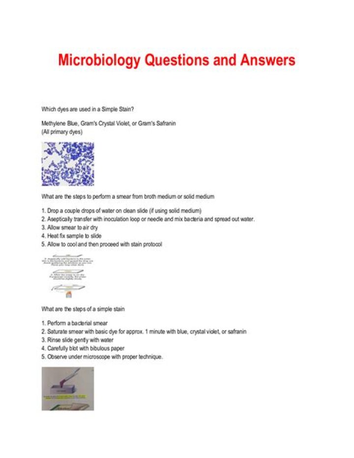 Microbiology Essay Questions and Answers PDF: Best Study Resources