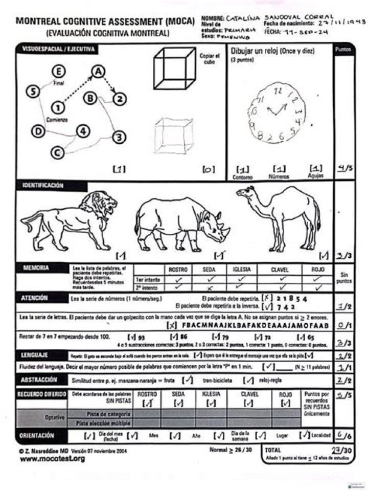 Moca Test PDF Download – Fast & Reliable