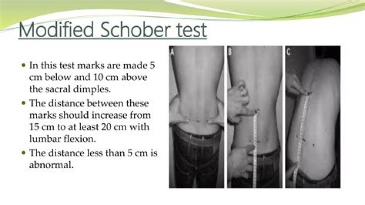Modified Schober Test PDF: Official Guide & Clinical Insights