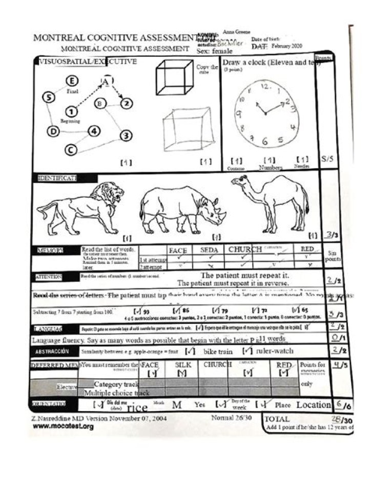 Download Montreal Cognitive Assessment Test PDF Easily