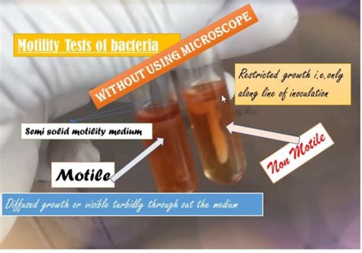 Motility Test for Bacteria PDF – Essential Lab Guide