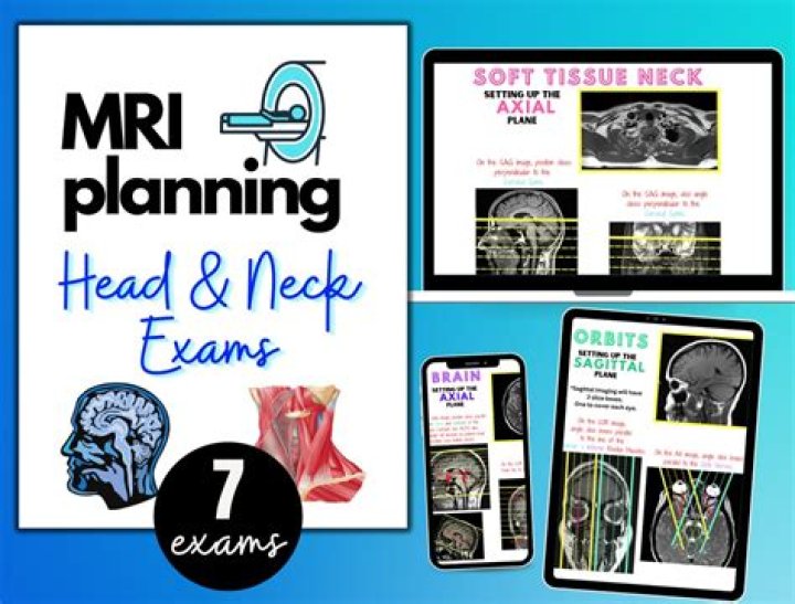 MRI Planning and Positioning PDF Guide for Accurate Imaging