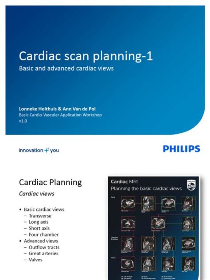 MRI Planning PDF Templates for Easy Pre-Scan Preparation