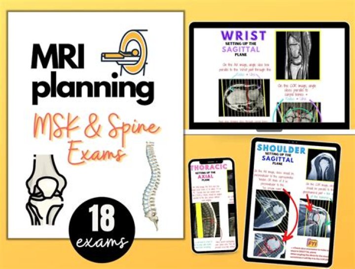 Optimize MRI Positioning & Planning: Essential PDF Guide