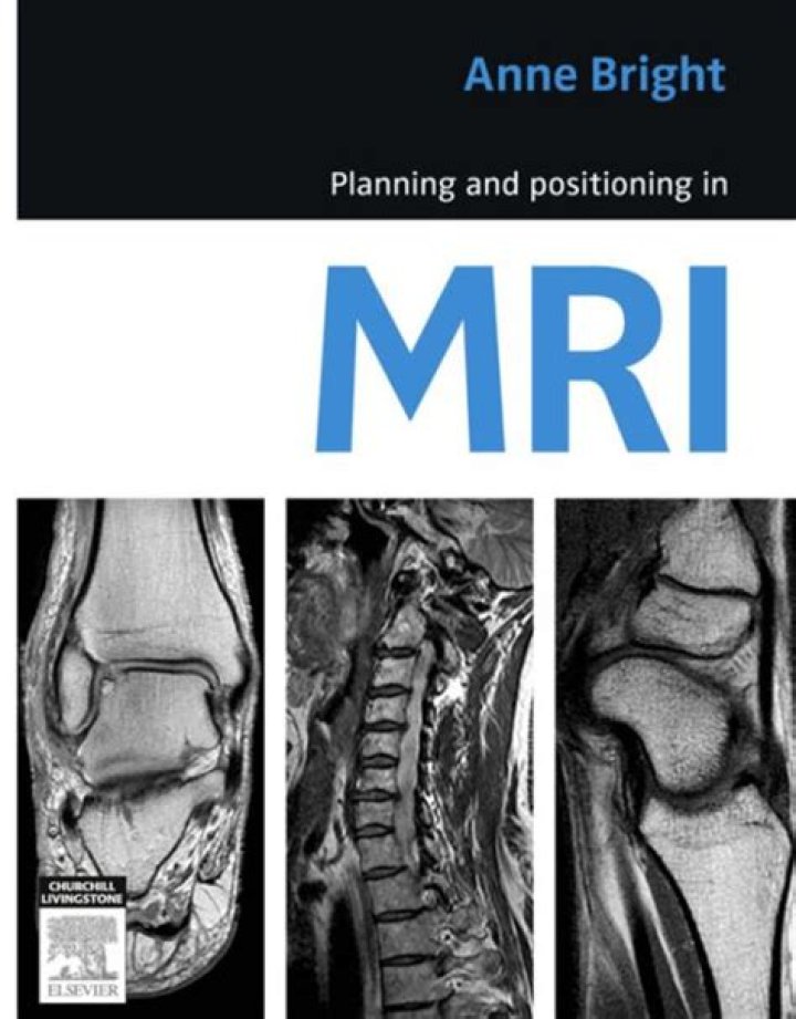 MRI Protocols and Planning PDF: Essential Guidelines for Accurate Scans
