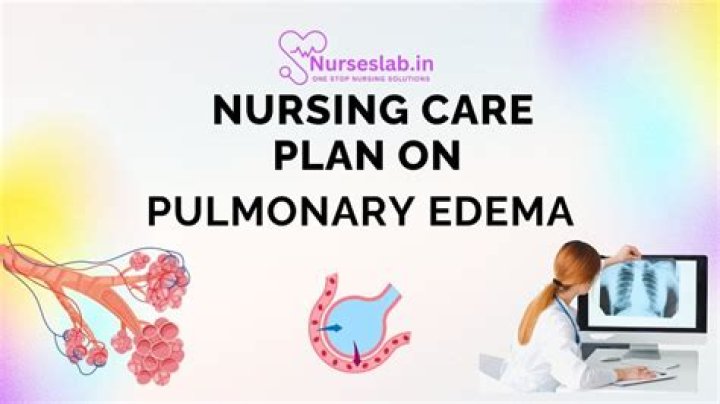 Nursing Care Plan for Pulmonary Edema: Essential PDF Guide