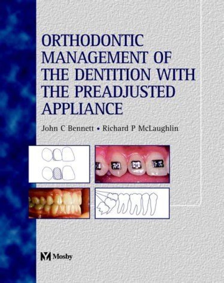 Effective Orthodontic Management of the Dentition Using Preadjusted Appliances: A Comprehensive Guide