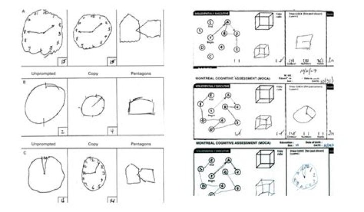 Complete Pi Cognitive Test PDF – Instant Results & Analysis