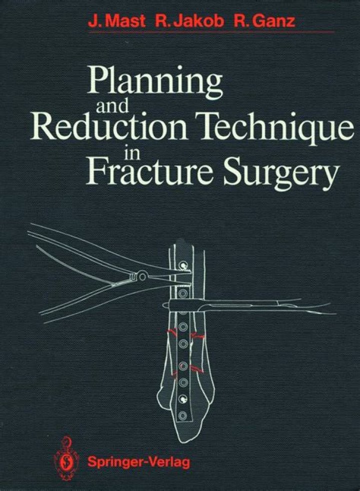Mastering Planning and Reduction Techniques in Fracture Surgery: A Comprehensive PDF Guide