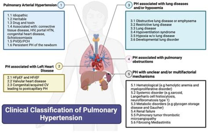 Pulmonary Hypertensive Crisis Management: Essential PDF Guide