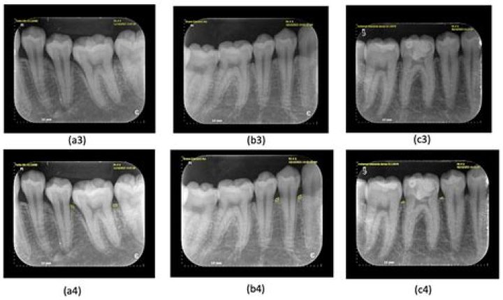 Radiographic Testing Level 2 PDF: Comprehensive Guide & Standards