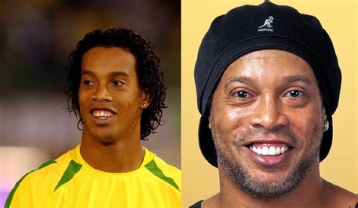 Ronaldinho Before And After