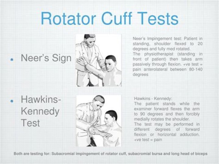 Rotator Cuff Special Tests PDF: Essential Diagnostic Guides & Exercises