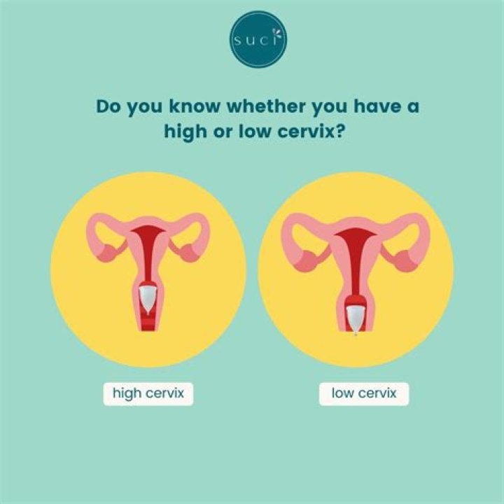 Should cervix be high or low before labor?