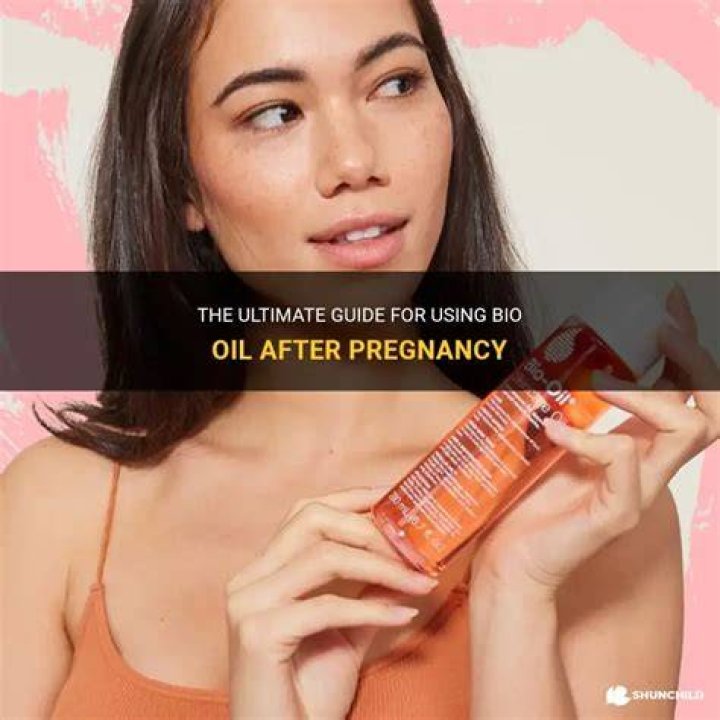 Should I use Bio-Oil before or after pregnancy?