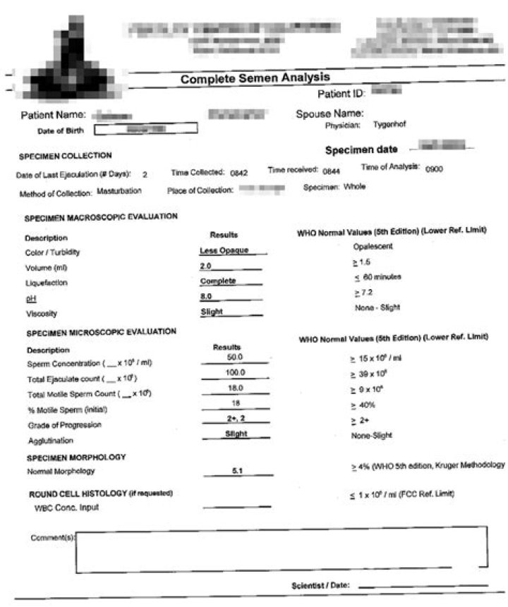 Sperm Count Test Report PDF: Accurate & Reliable Results