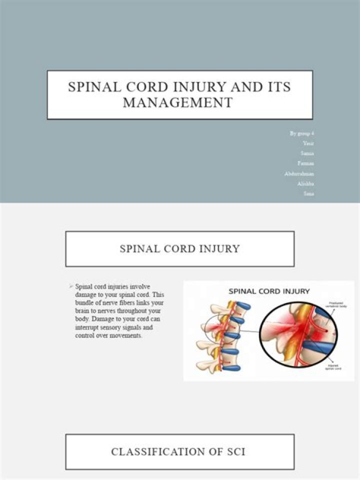Spinal Cord Injury Management PDF: Essential Care & Recovery Guide