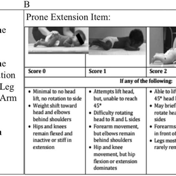 Comprehensive Test of Infant Motor Performance PDF