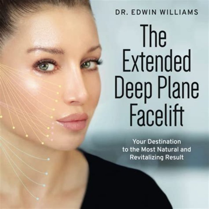 The Art and Science of Extended Deep Plane Facelifting: Comprehensive PDF Guide
