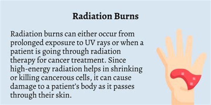 The Horrific Radiation Burns Of Hisashi Ouchi A Japanese Tragedy
