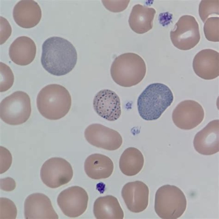 What are basophilic inclusions?