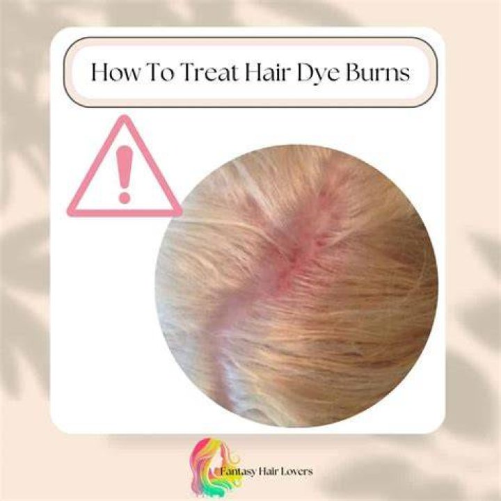 What can I put on a chemical burn on my scalp?
