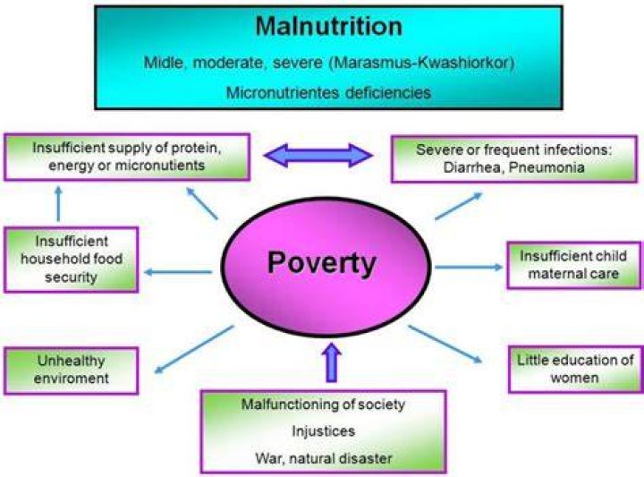 What causes malnutrition babies?