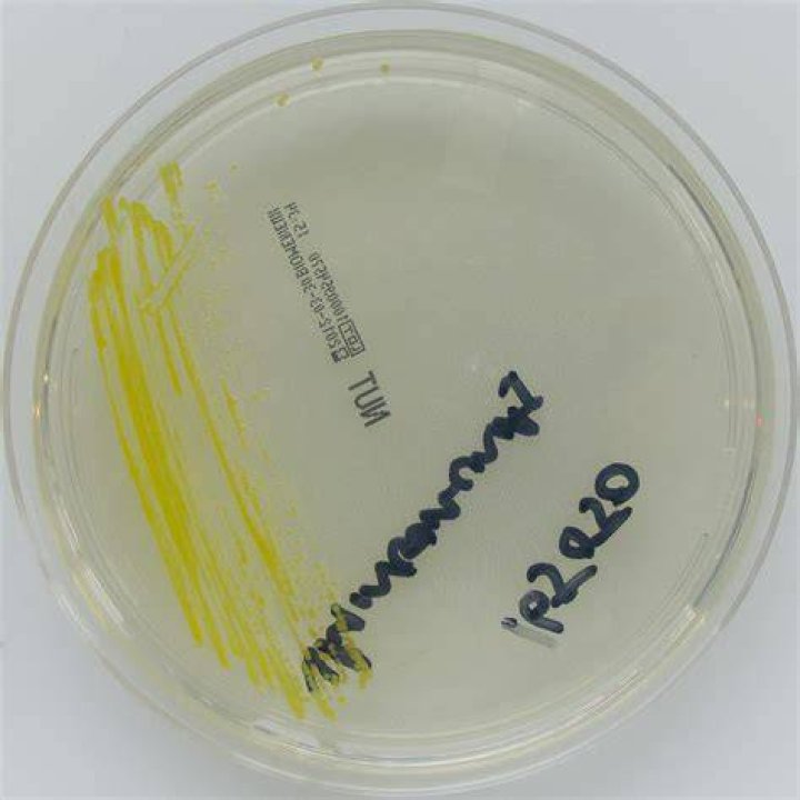 What causes Sphingomonas paucimobilis?