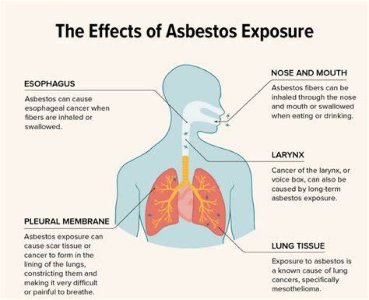 What does exposure to asbestos cause?