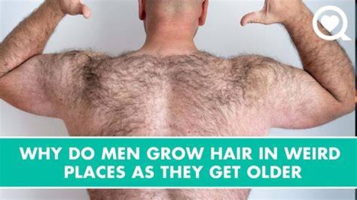 What does it mean if a man has no hair on his legs?
