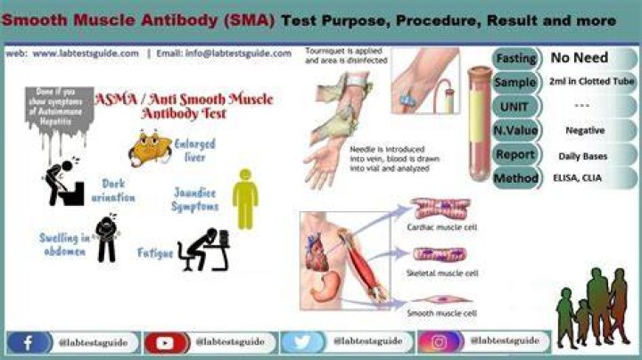 What does smooth muscle AB screen positive mean?
