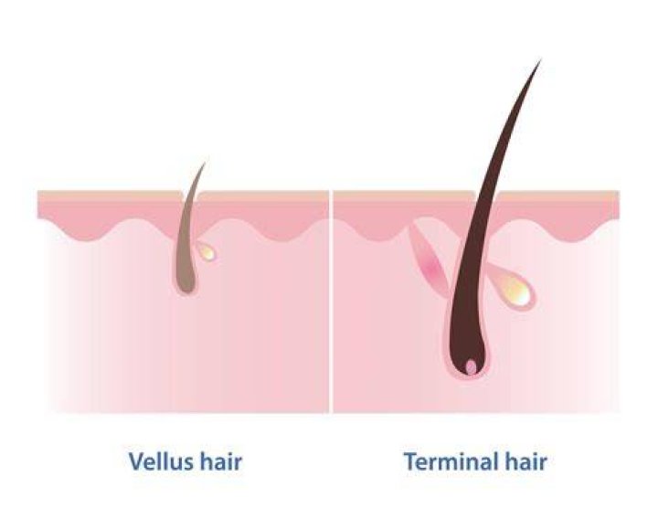 What hair is replaced by Vellus?