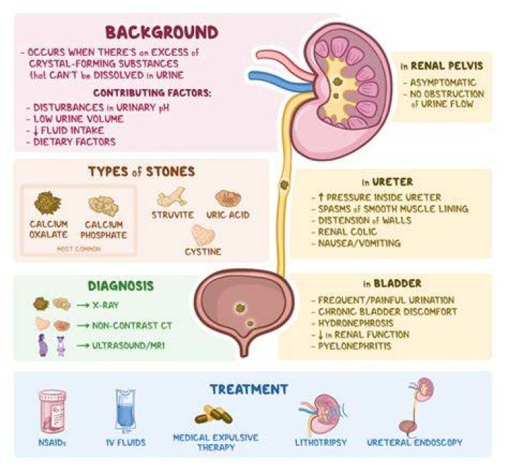 What is a more common name for nephrolithiasis?