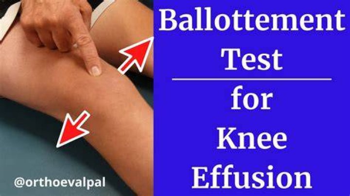 What is a positive Ballottement test?