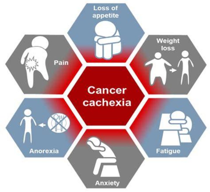 What is cancer associated anorexia cachexia syndrome?