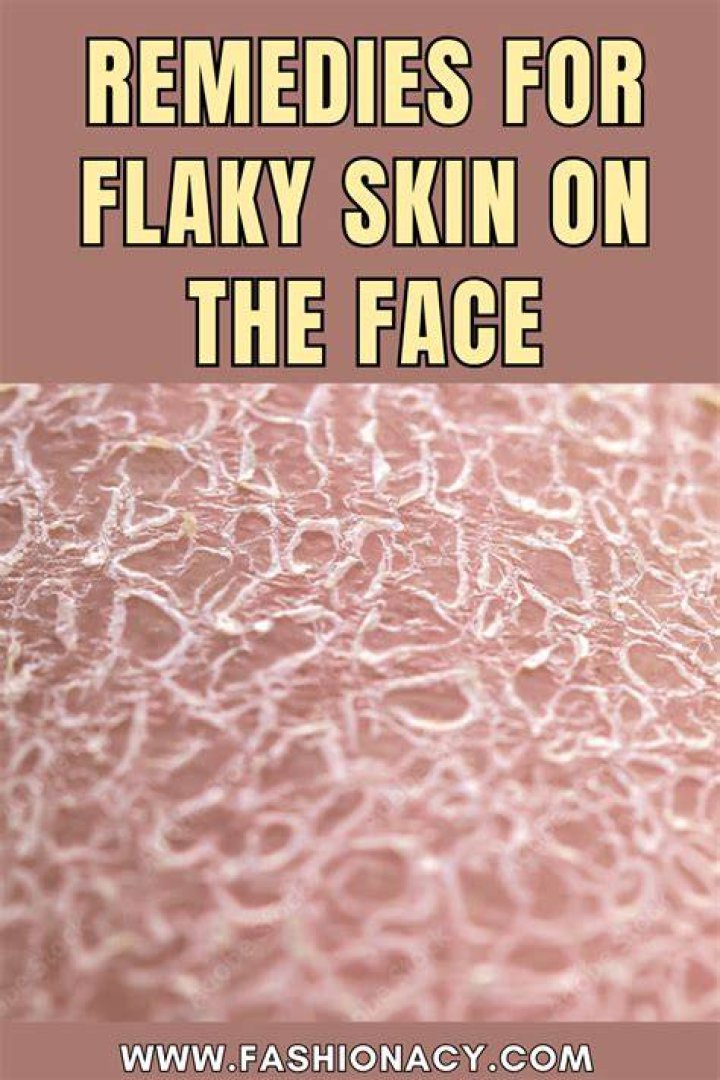 What is the fastest way to heal flaky skin?