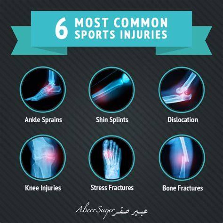 What is the most common injury in cheerleading?
