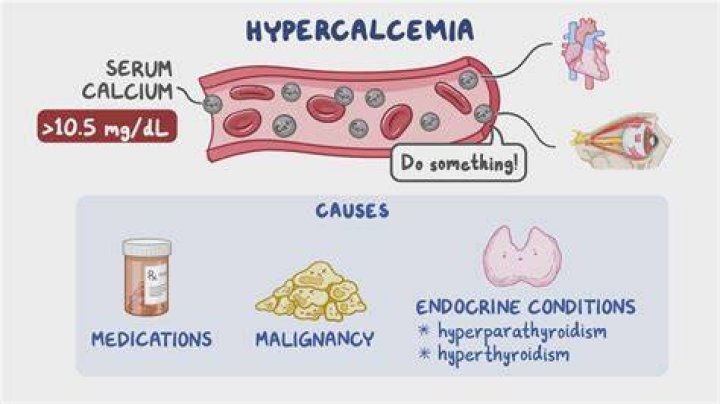 What IV is used for hypercalcemia?