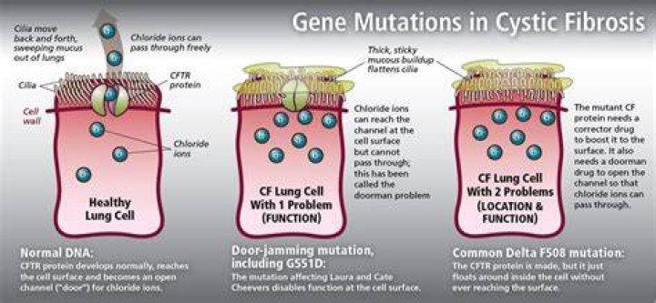 What type of gene mutation is cystic fibrosis?
