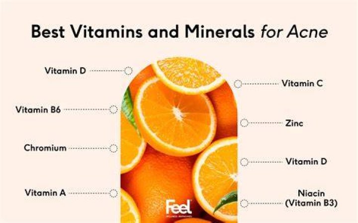 What vitamins are good for acne?