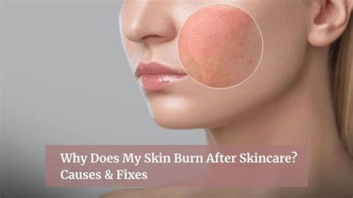Why is my ball skin burning?