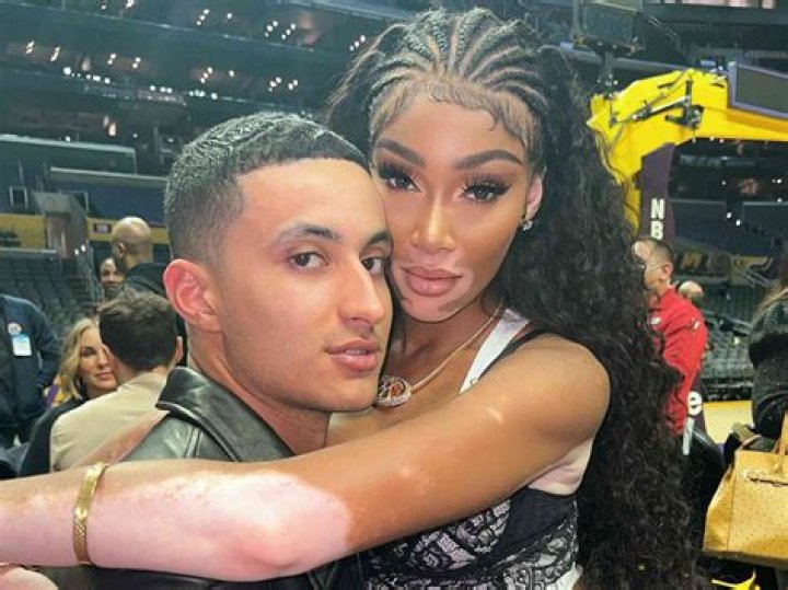 Winnie Harlow and Kyle Kuzma are dating